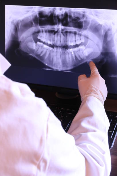 Best Emergency Wisdom Teeth Removal in Lavalette, WV